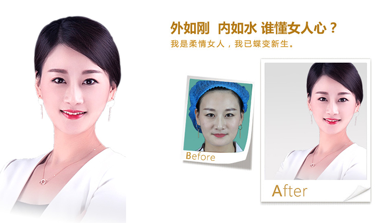 拉萨V脸、线雕隆鼻